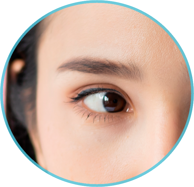 img-doenca-ocular-estrabismo