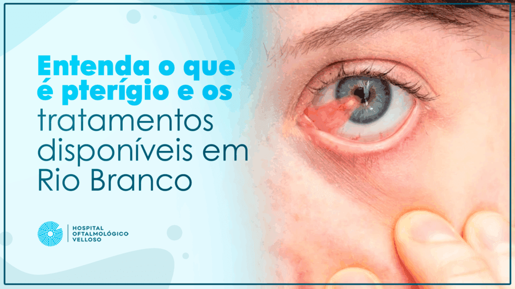 A imagem atual não possui texto alternativo. O nome do arquivo é: ARTIGO-MAR-1.png